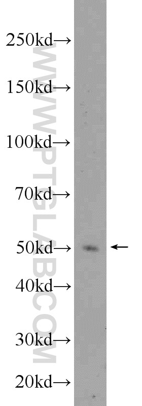 Western Blot (WB) analysis of K-562 cells using Chk1 Polyclonal antibody (10362-1-AP)