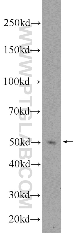 WB analysis of K-562 using 10362-1-AP