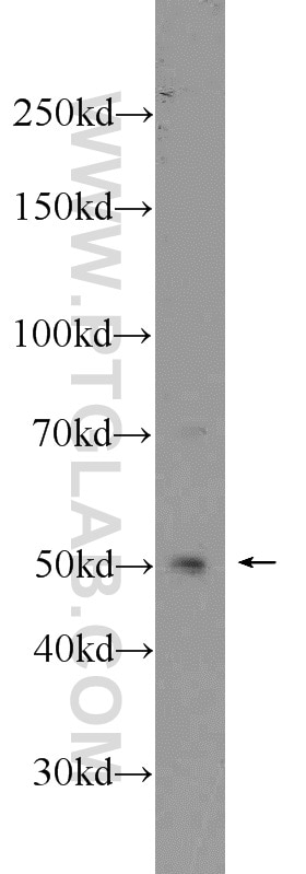Western Blot (WB) analysis of HeLa cells using Chk1 Polyclonal antibody (10362-1-AP)
