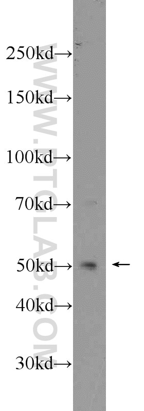 WB analysis of HeLa using 10362-1-AP