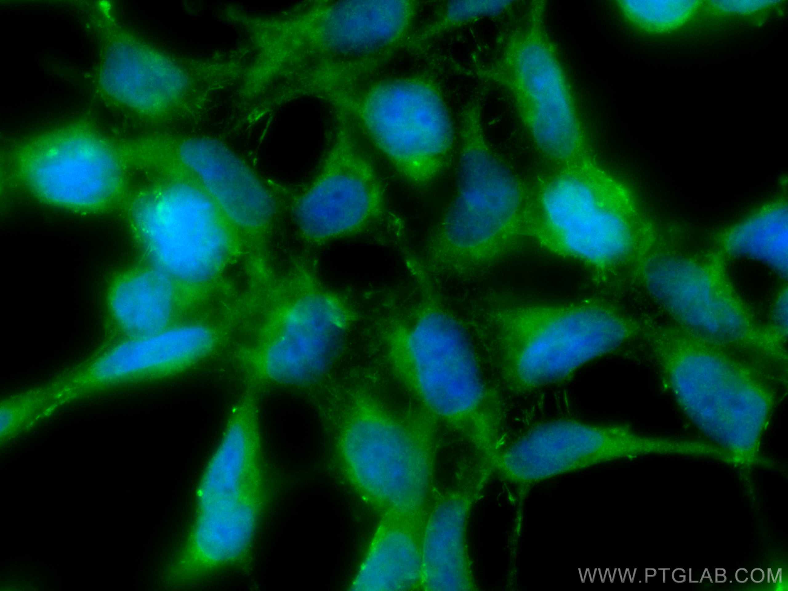 Immunofluorescence (IF) / fluorescent staining of HEK-293T cells using Chk1 Polyclonal antibody (25887-1-AP)