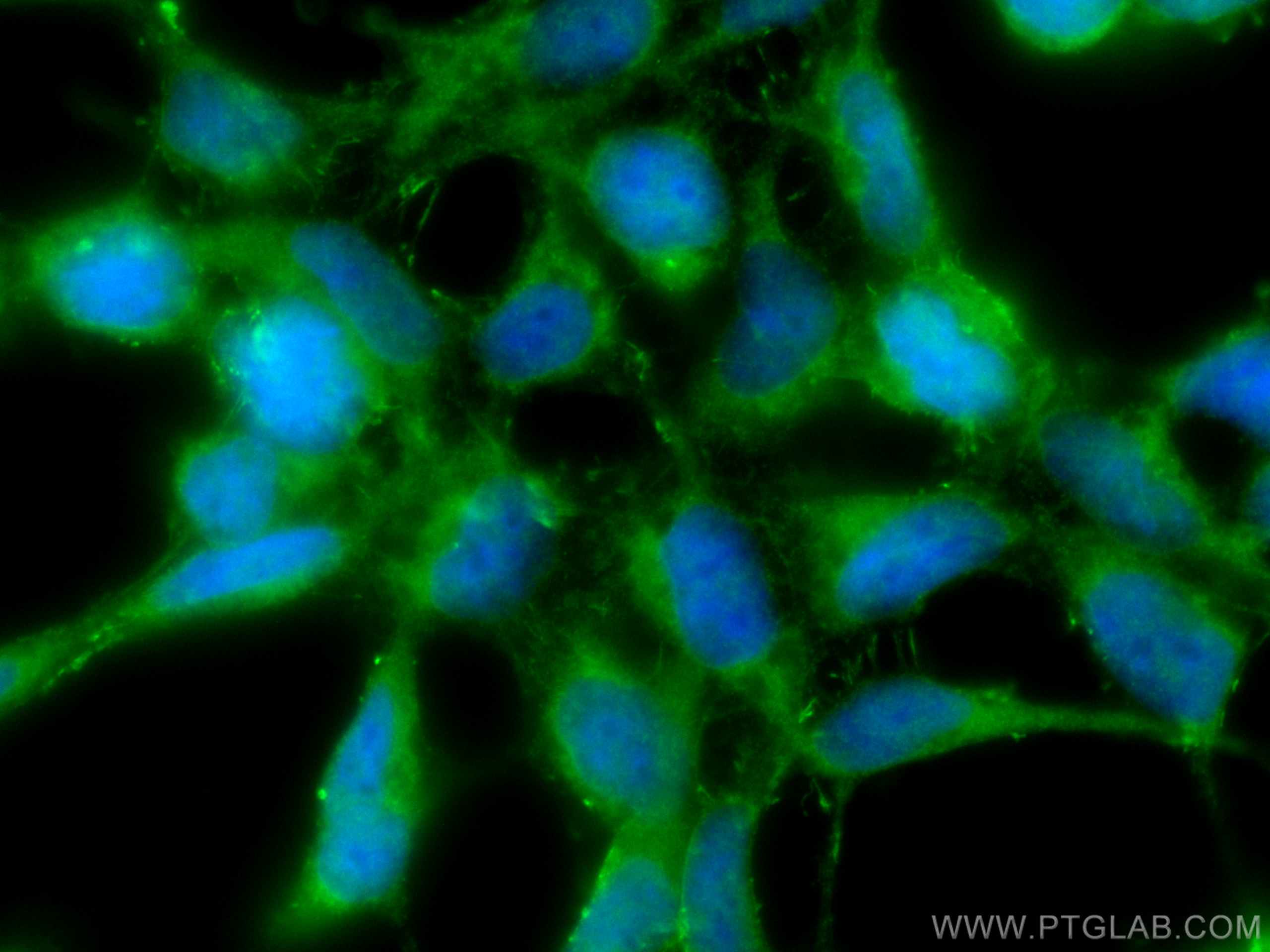 IF Staining of HEK-293T using 25887-1-AP