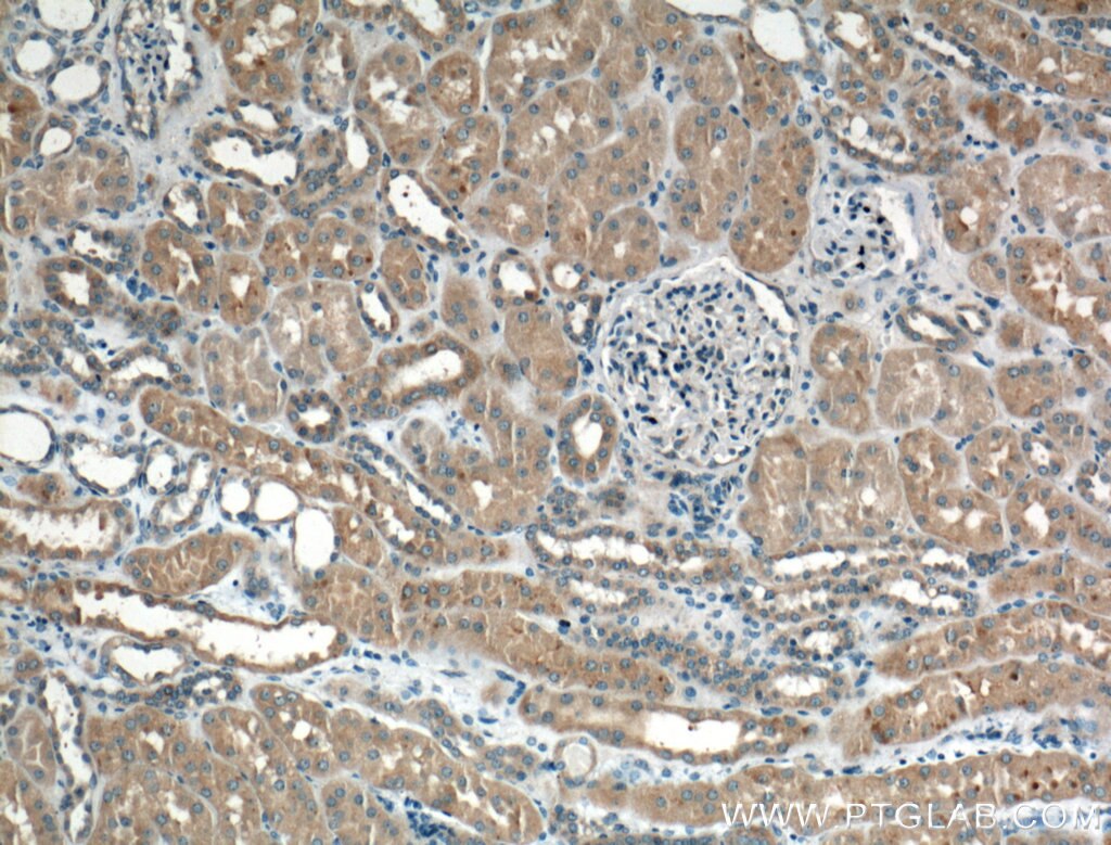 Immunohistochemistry (IHC) staining of human kidney tissue using Chk1 Polyclonal antibody (25887-1-AP)