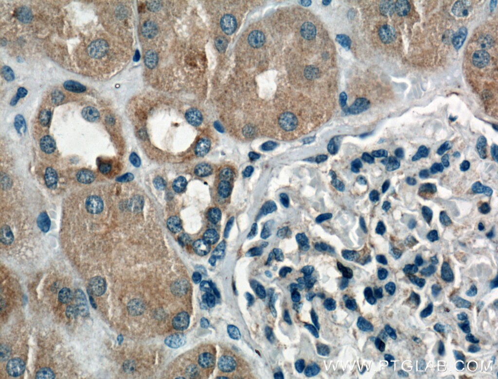 Immunohistochemistry (IHC) staining of human kidney tissue using Chk1 Polyclonal antibody (25887-1-AP)