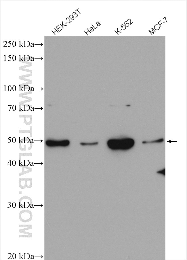 Western Blot (WB) analysis of various lysates using Chk1 Polyclonal antibody (25887-1-AP)