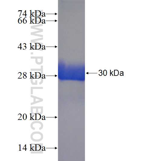 CHK1 fusion protein Ag22993 SDS-PAGE