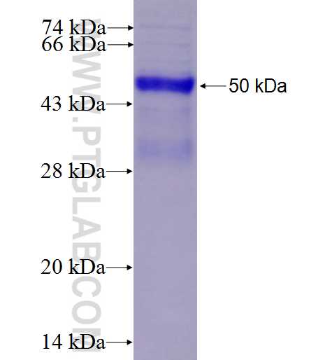 CHK1 fusion protein Ag0409 SDS-PAGE