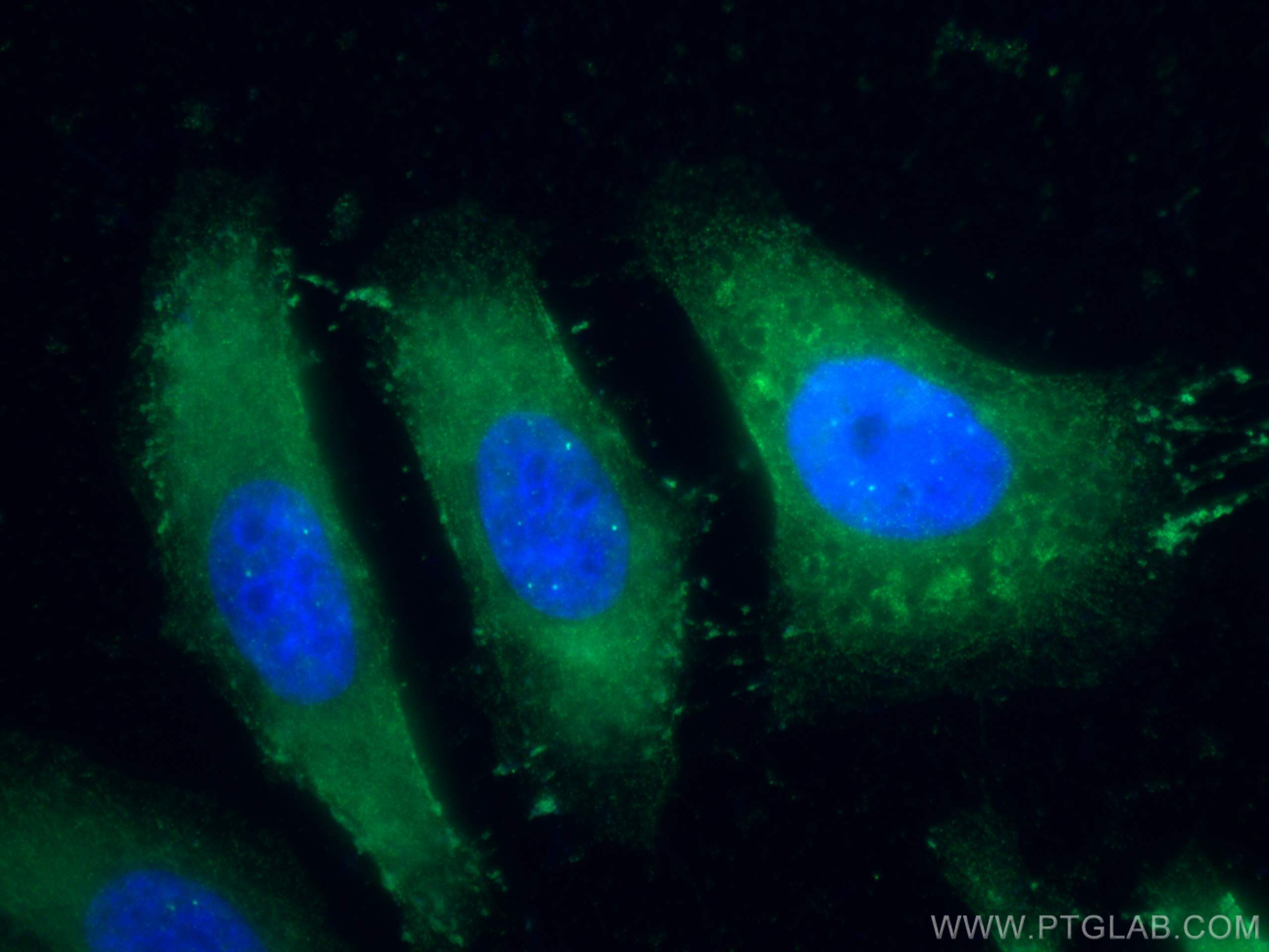 Immunofluorescence (IF) / fluorescent staining of HeLa cells using Choline Kinase Alpha Polyclonal antibody (13520-1-AP)