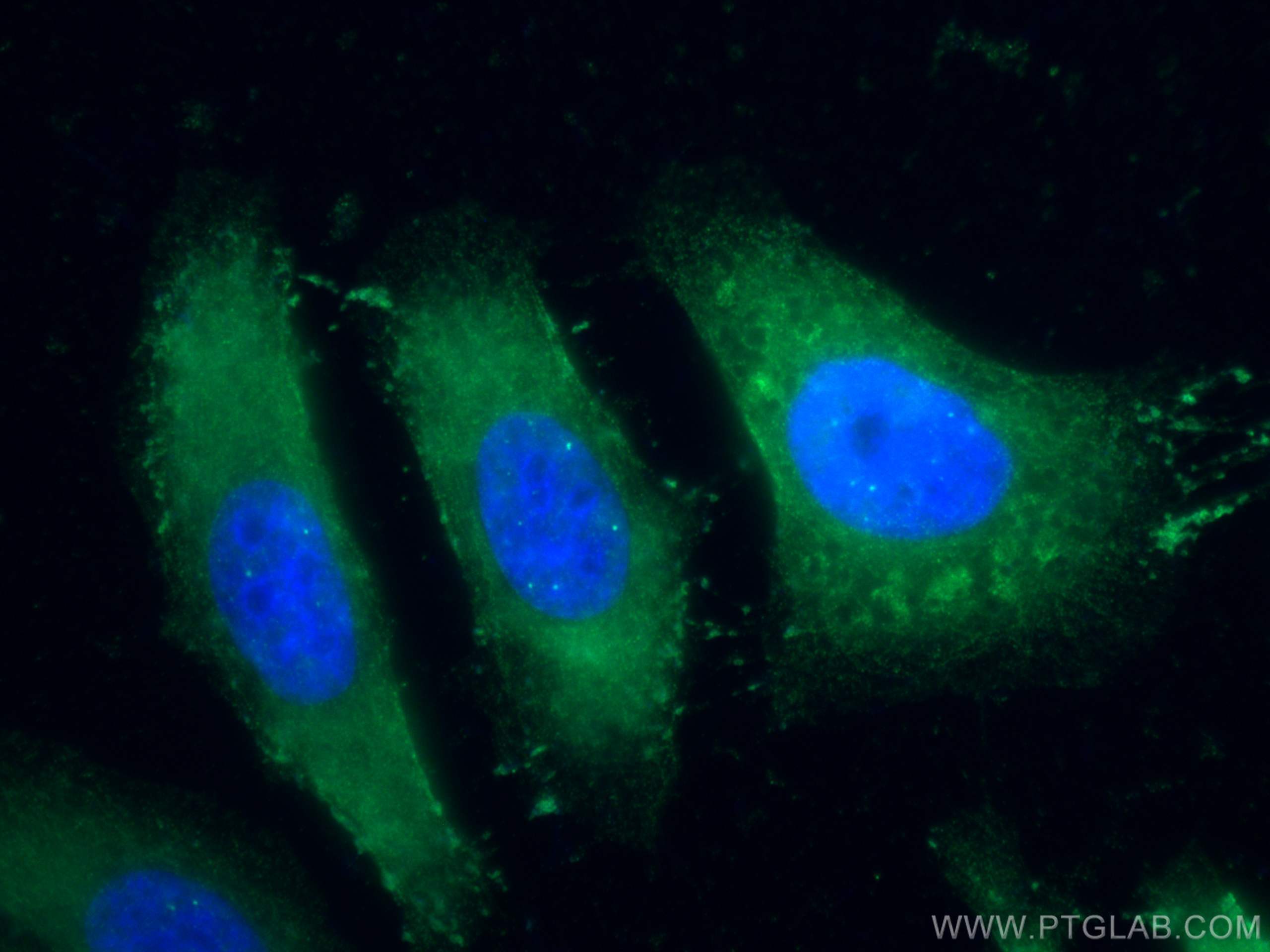 IF Staining of HeLa using 13520-1-AP