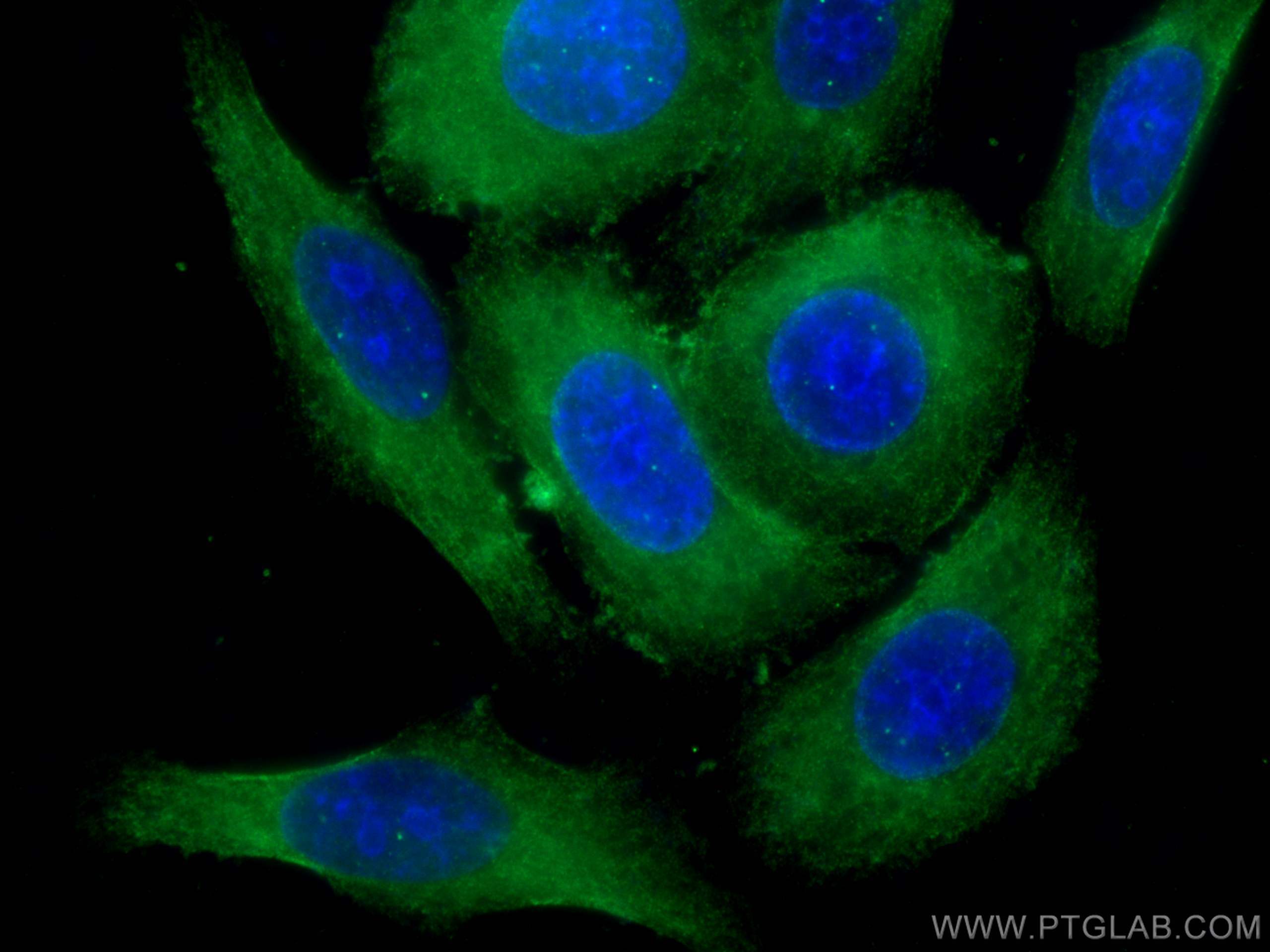 Immunofluorescence (IF) / fluorescent staining of HeLa cells using Choline Kinase Alpha Polyclonal antibody (13520-1-AP)