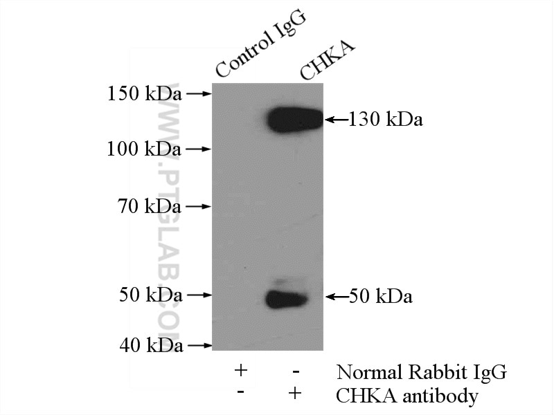 Immunoprecipitation (IP) experiment of mouse spleen tissue using Choline Kinase Alpha Polyclonal antibody (13520-1-AP)