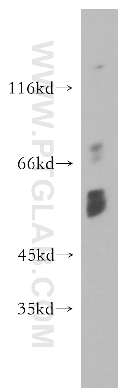 Western Blot (WB) analysis of COLO 320 cells using Choline Kinase Alpha Polyclonal antibody (13520-1-AP)