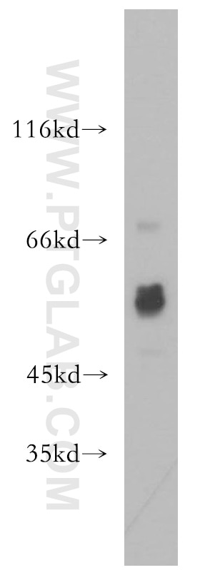 Western Blot (WB) analysis of mouse colon tissue using Choline Kinase Alpha Polyclonal antibody (13520-1-AP)