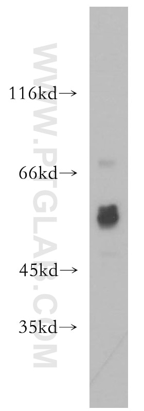 WB analysis of mouse colon using 13520-1-AP