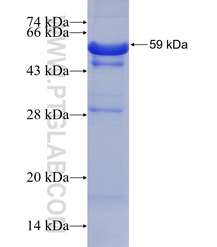 CHKA fusion protein Ag4761 SDS-PAGE