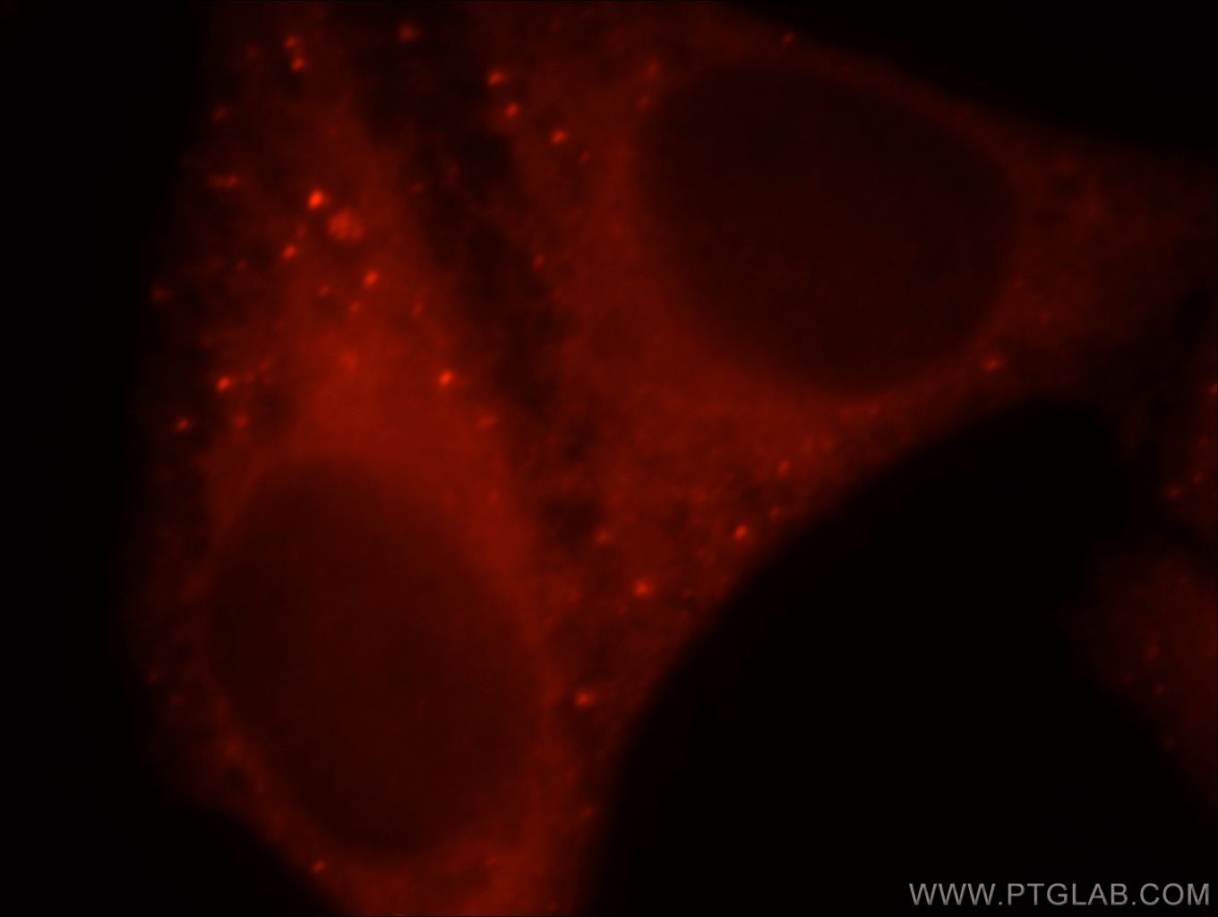 Immunofluorescence (IF) / fluorescent staining of HepG2 cells using CHKA-Specific Polyclonal antibody (19537-1-AP)