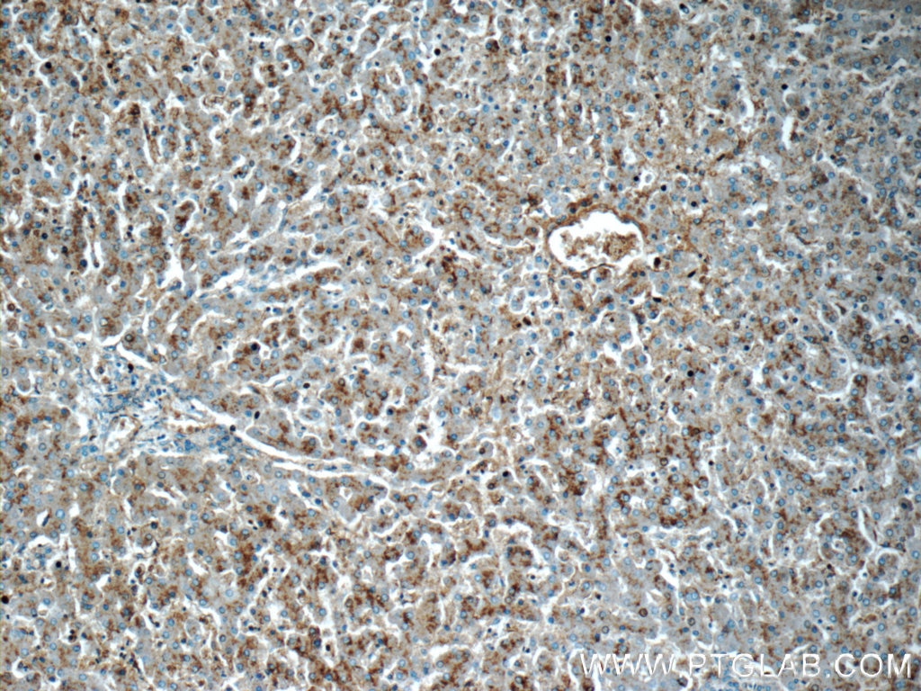 IHC staining of human liver using 19537-1-AP