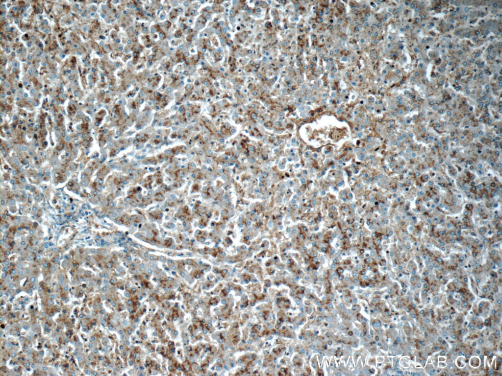 Immunohistochemistry (IHC) staining of human liver tissue using CHKA-Specific Polyclonal antibody (19537-1-AP)