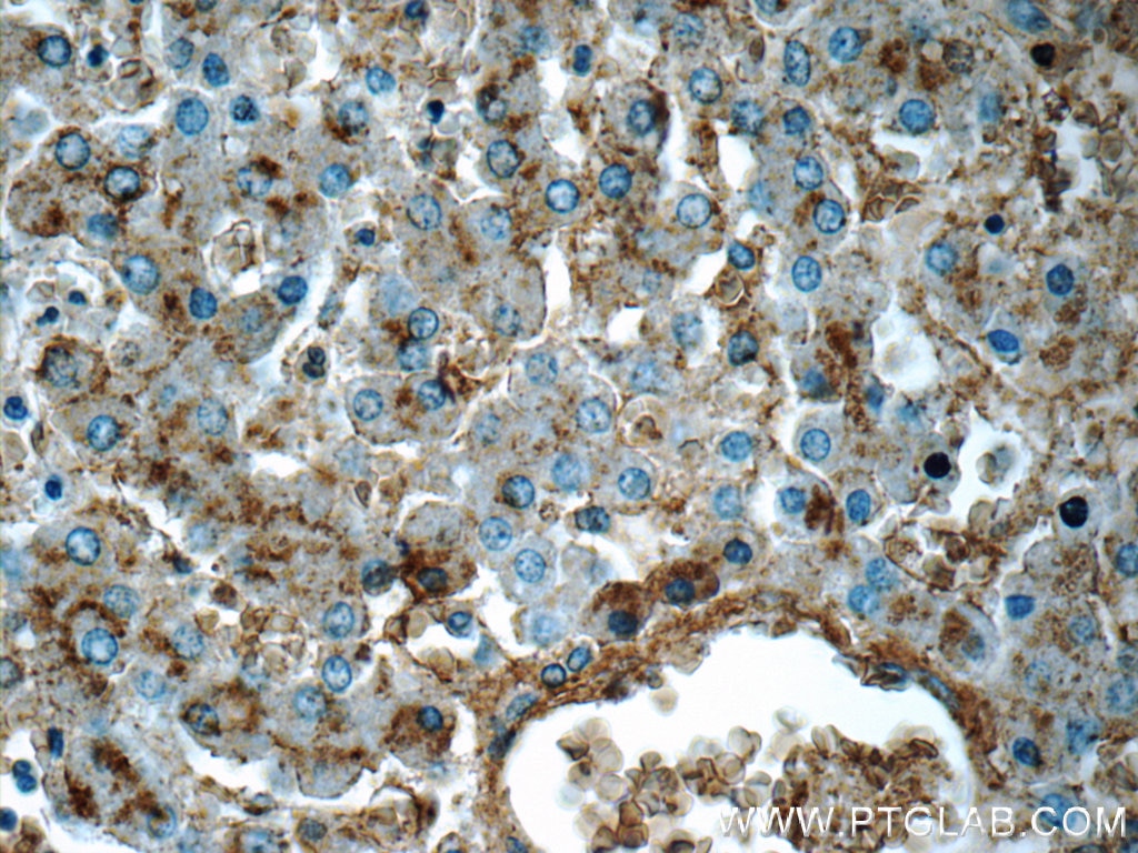 Immunohistochemistry (IHC) staining of human liver tissue using CHKA-Specific Polyclonal antibody (19537-1-AP)