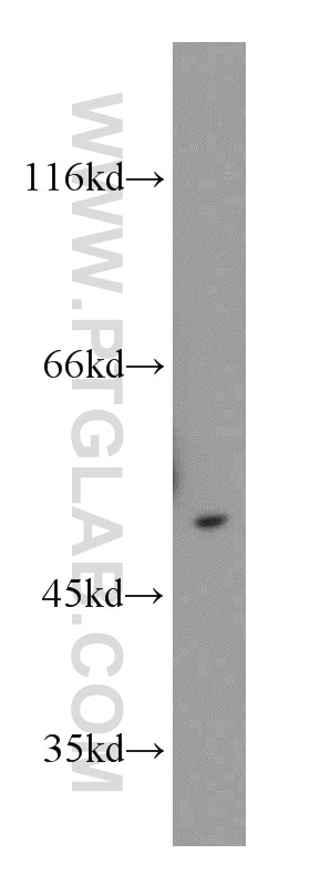 Western Blot (WB) analysis of mouse testis tissue using CHKA-Specific Polyclonal antibody (19537-1-AP)