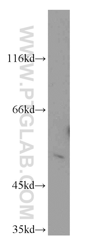 Western Blot (WB) analysis of Raji cells using CHKA-Specific Polyclonal antibody (19537-1-AP)