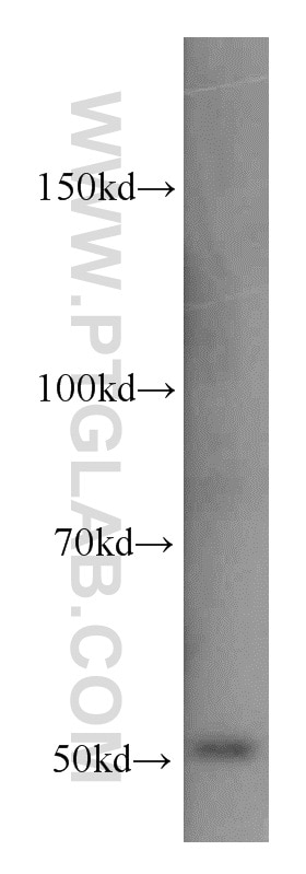 Western Blot (WB) analysis of mouse testis tissue using CHKA-Specific Polyclonal antibody (19537-1-AP)