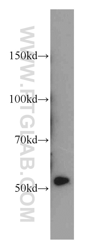 Western Blot (WB) analysis of mouse testis tissue using CHKA-Specific Polyclonal antibody (19537-1-AP)