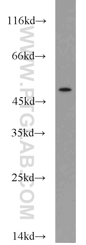 Western Blot (WB) analysis of mouse colon tissue using CHKA-Specific Polyclonal antibody (19537-1-AP)