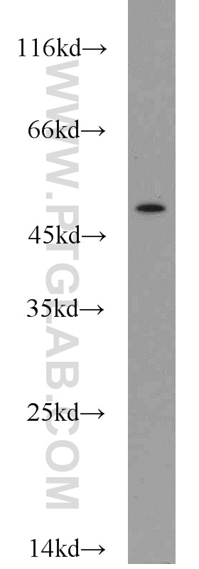 WB analysis of mouse colon using 19537-1-AP