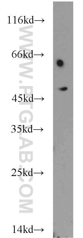 Western Blot (WB) analysis of COLO 320 cells using CHKA-Specific Polyclonal antibody (19537-1-AP)