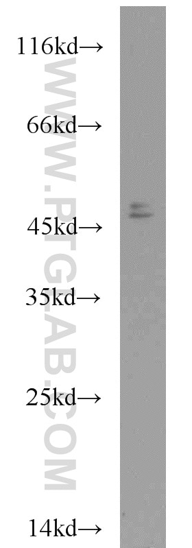 Western Blot (WB) analysis of COLO 320 cells using CHKA-Specific Polyclonal antibody (19537-1-AP)