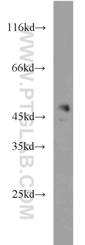 Western Blot (WB) analysis of human testis tissue using CHKA-Specific Polyclonal antibody (19537-1-AP)