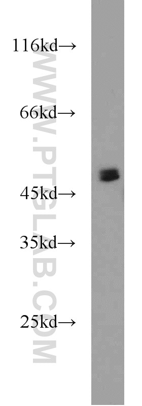Western Blot (WB) analysis of human testis tissue using CHKA-Specific Polyclonal antibody (19537-1-AP)