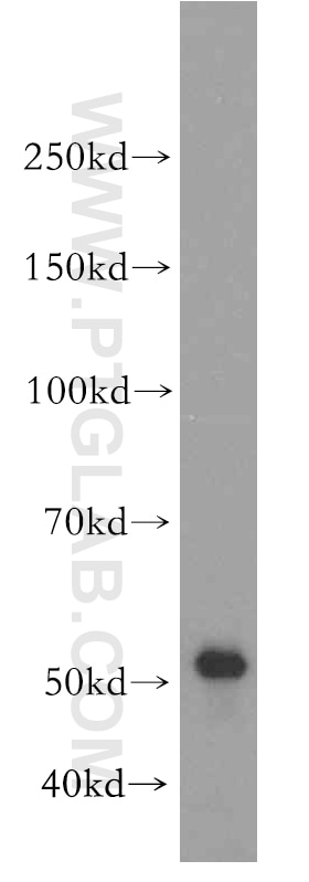 Western Blot (WB) analysis of HepG2 cells using CHKA-Specific Polyclonal antibody (19537-1-AP)