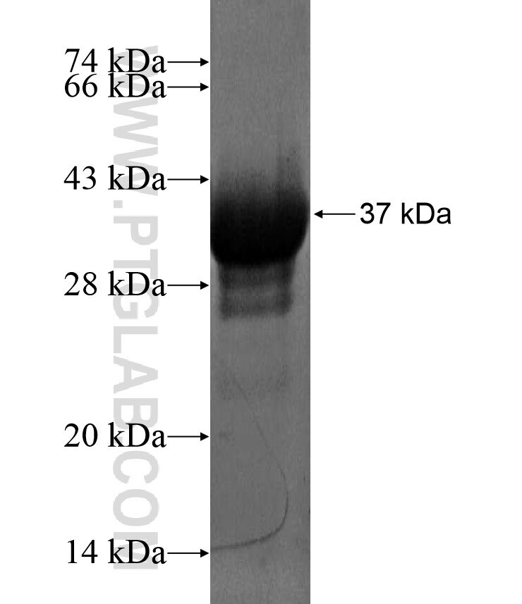 CHKB fusion protein Ag17142 SDS-PAGE