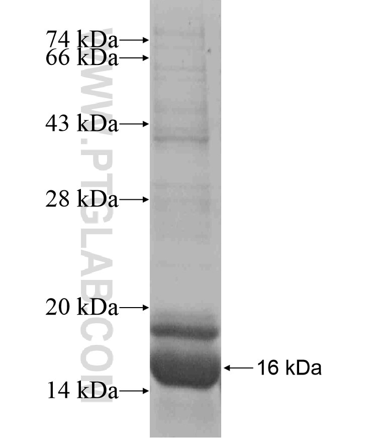 CHKB fusion protein Ag17472 SDS-PAGE