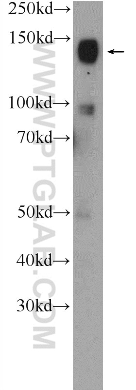 Western Blot (WB) analysis of mouse brain tissue using CHL1 Polyclonal antibody (25250-1-AP)