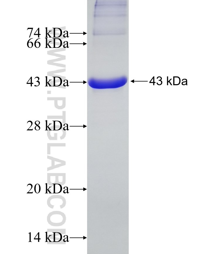 CHL1 fusion protein Ag19263 SDS-PAGE