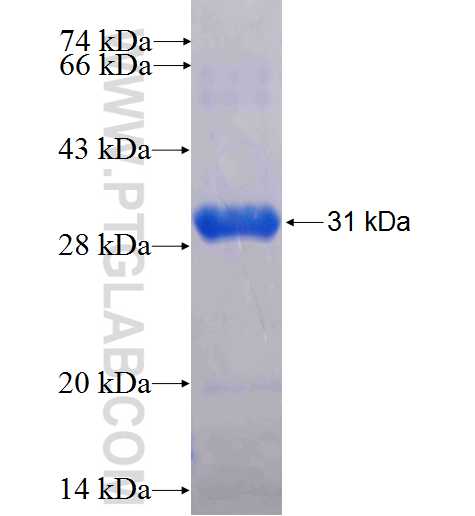 CHM fusion protein Ag23166 SDS-PAGE