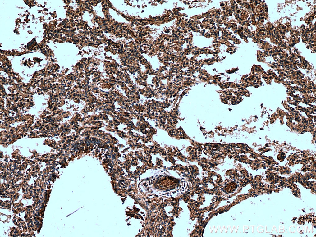 Immunohistochemistry (IHC) staining of human lung tissue using CHMP1A Polyclonal antibody (15761-1-AP)