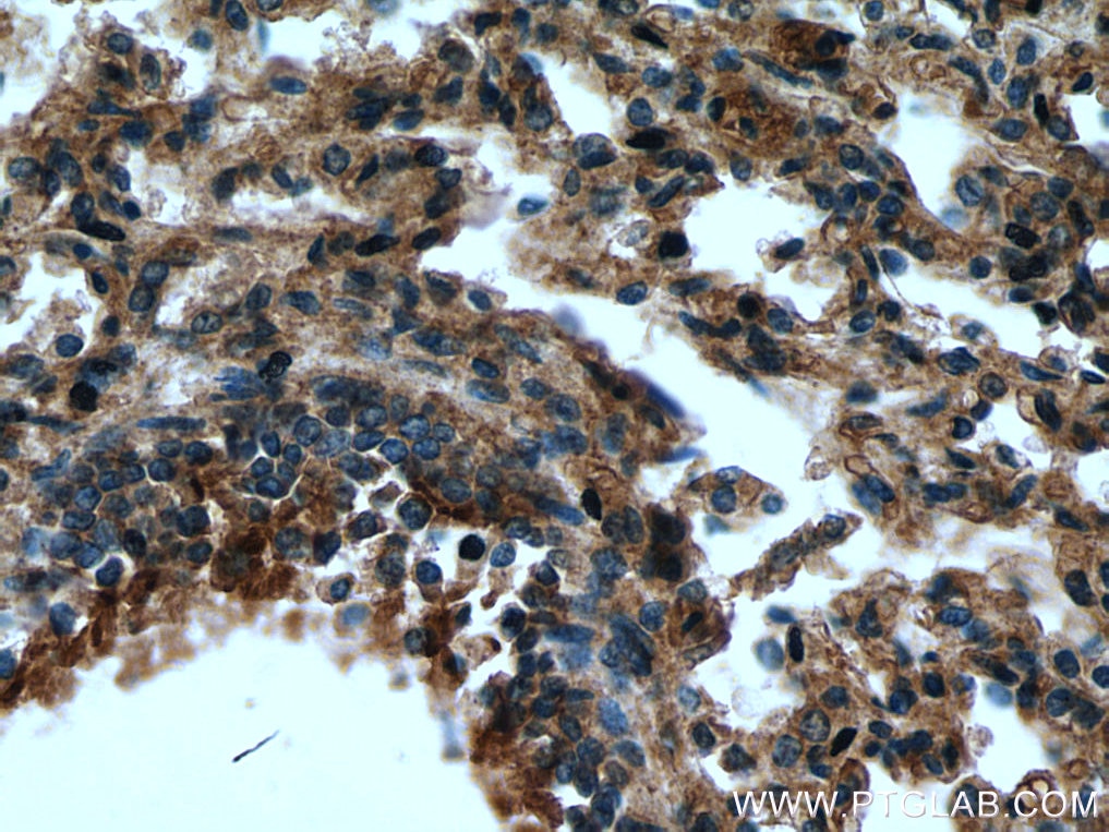 Immunohistochemistry (IHC) staining of human lung tissue using CHMP1A Polyclonal antibody (15761-1-AP)