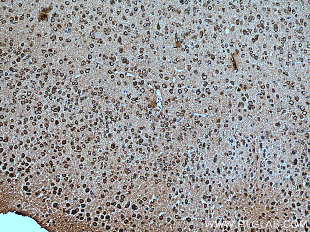IHC staining of mouse brain using 15761-1-AP