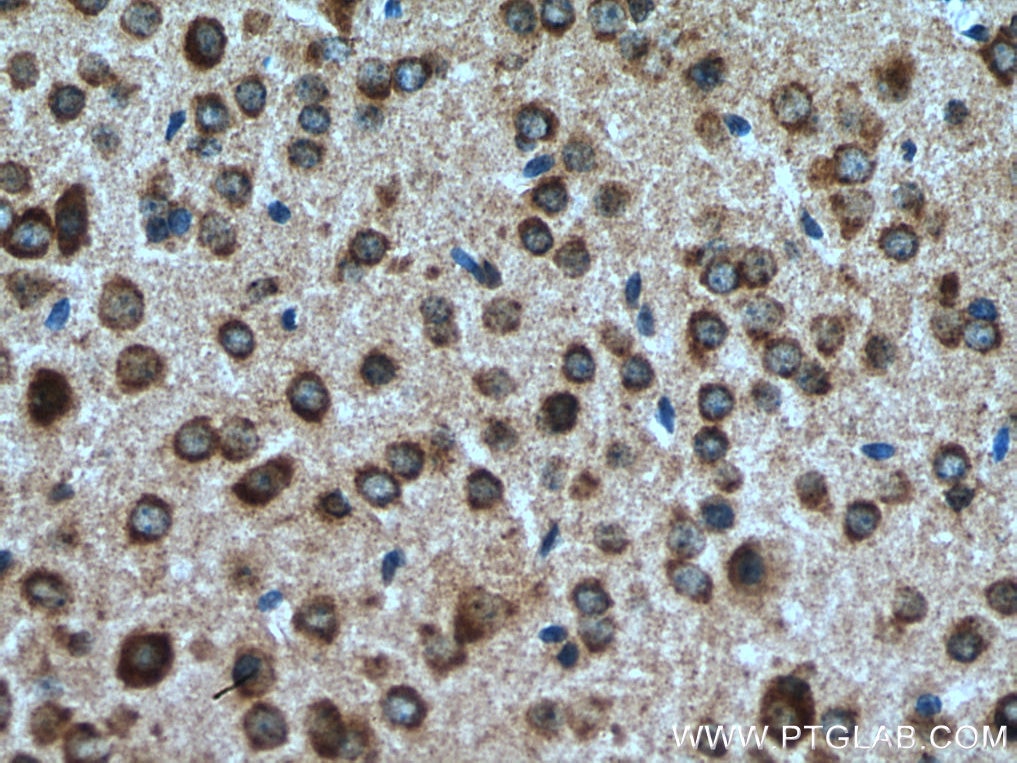 Immunohistochemistry (IHC) staining of mouse brain tissue using CHMP1A Polyclonal antibody (15761-1-AP)