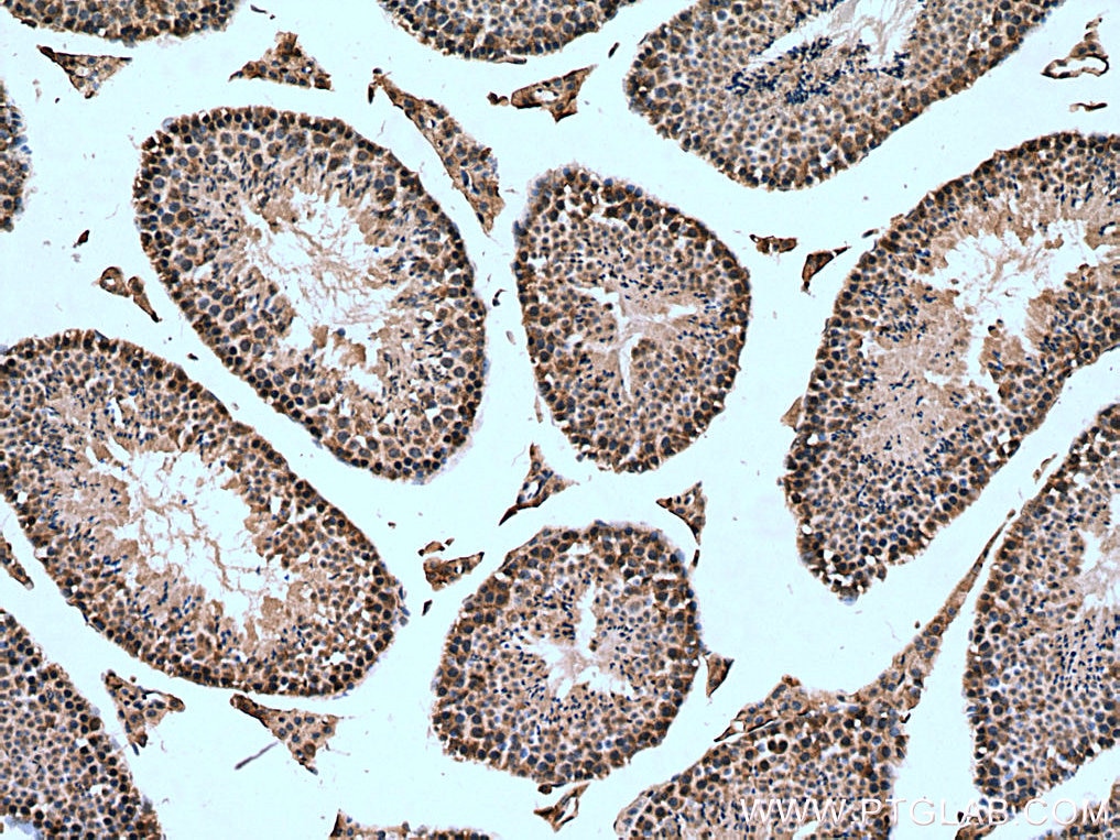 Immunohistochemistry (IHC) staining of mouse testis tissue using CHMP1A Polyclonal antibody (15761-1-AP)