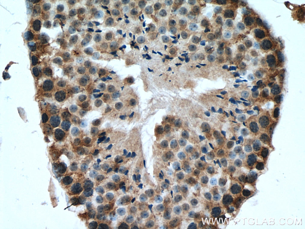 Immunohistochemistry (IHC) staining of mouse testis tissue using CHMP1A Polyclonal antibody (15761-1-AP)