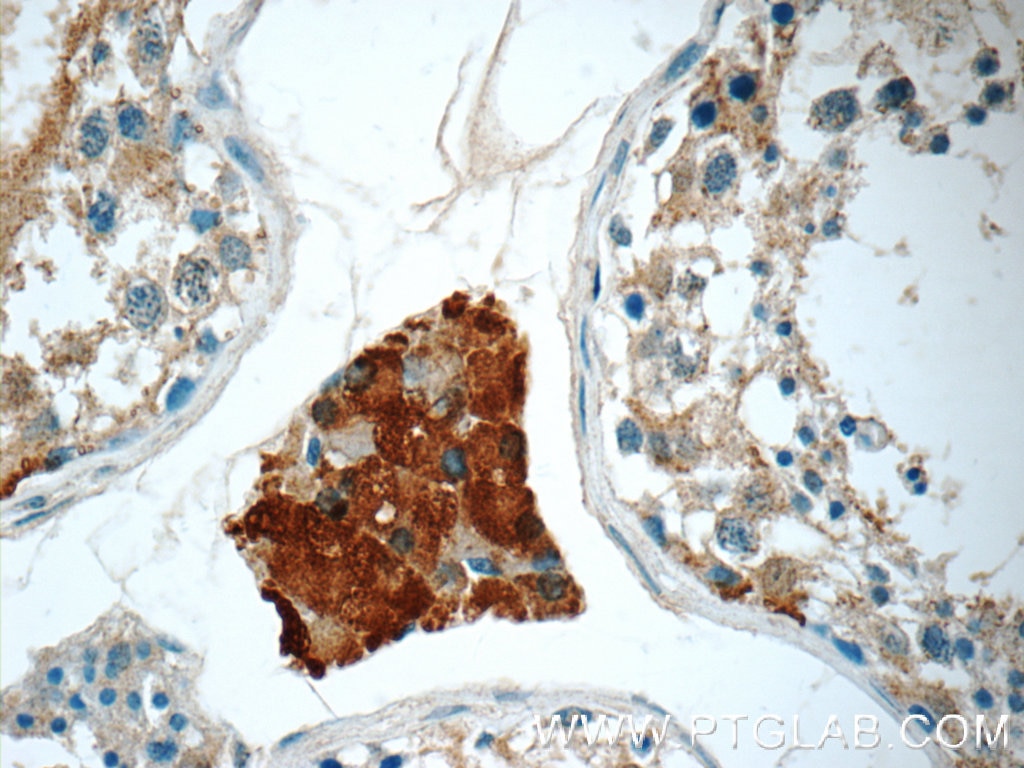 CHMP1A Polyclonal antibody