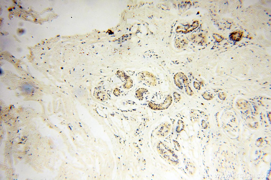 Immunohistochemistry (IHC) staining of human skin tissue using CHMP1A Polyclonal antibody (15761-1-AP)
