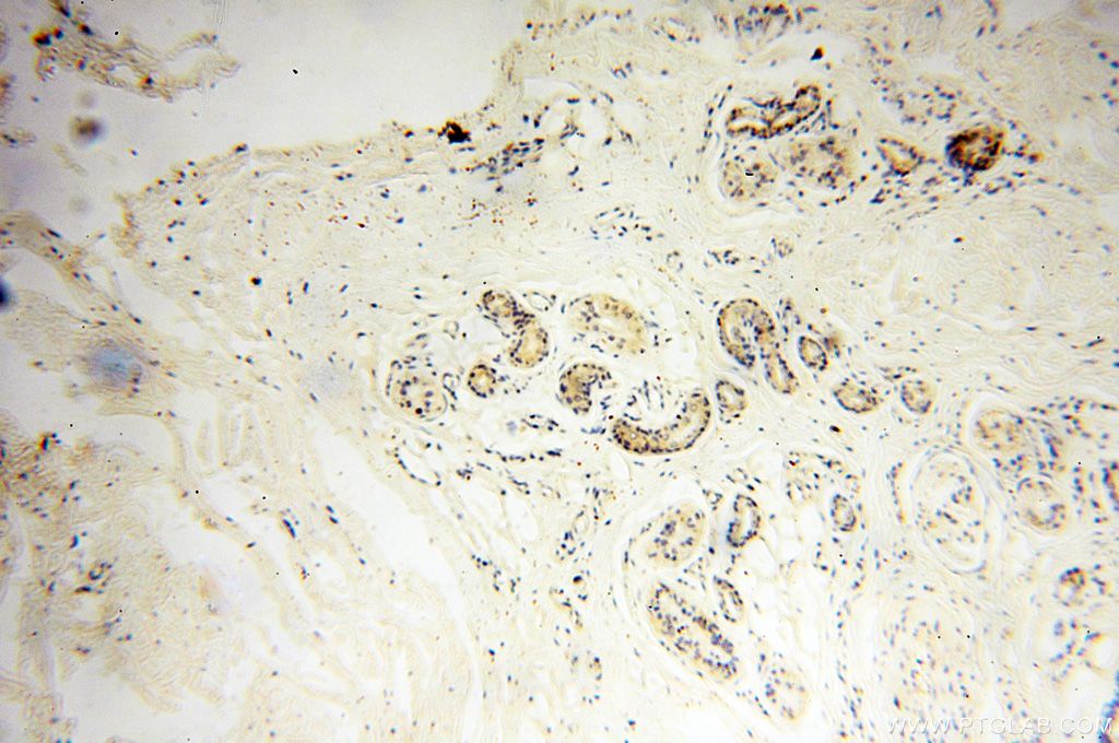 IHC staining of human skin using 15761-1-AP