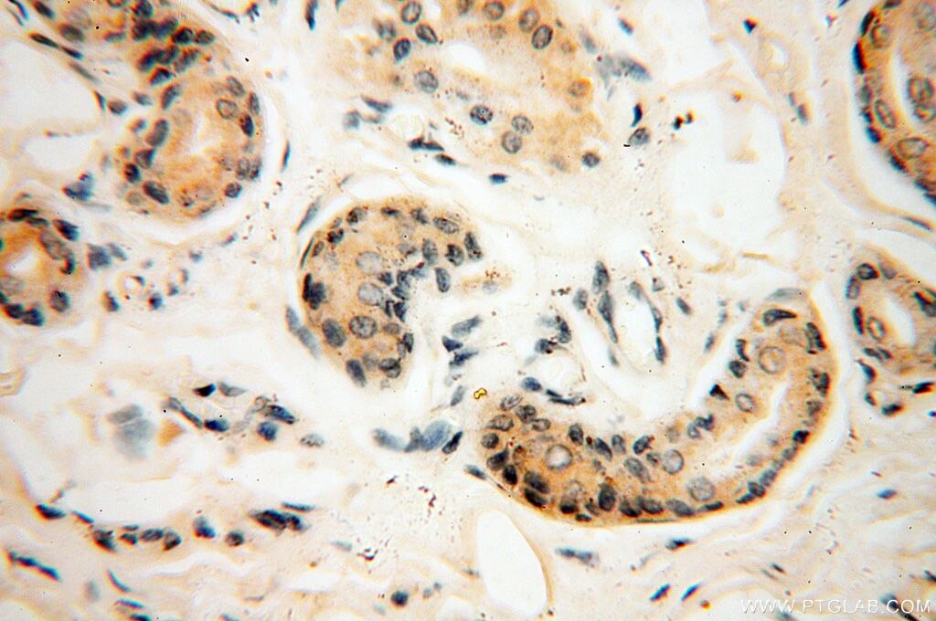 Immunohistochemistry (IHC) staining of human skin tissue using CHMP1A Polyclonal antibody (15761-1-AP)