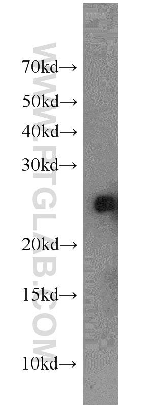 Western Blot (WB) analysis of HeLa cells using CHMP1A Polyclonal antibody (15761-1-AP)